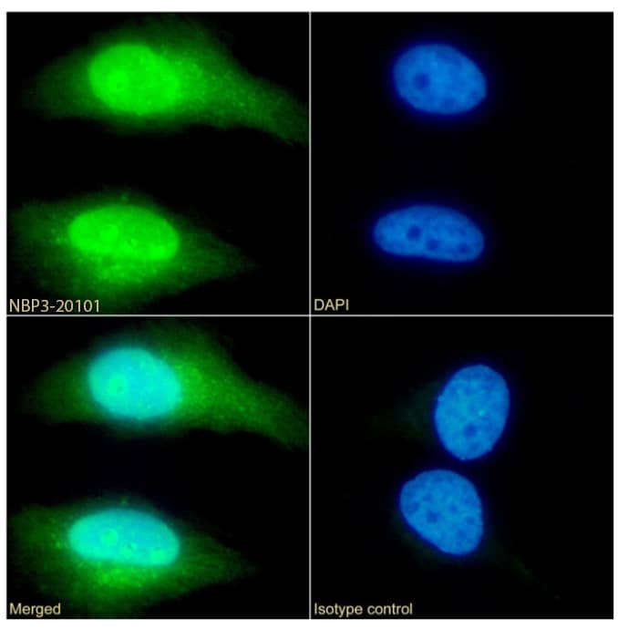 Transgelin/TAGLN/SM22 alpha Antibody (SAIC-33B-129) - Azide and BSA Free