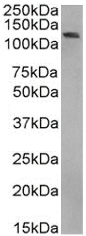 BRD4 Antibody (RAB-C131) - Chimeric - Azide and BSA Free