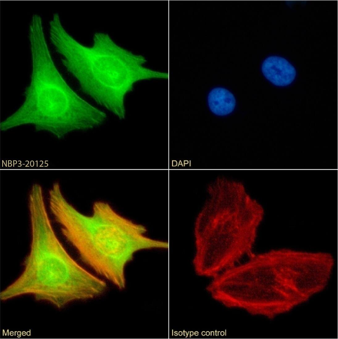BRD4 Antibody (RAB-C131) - Chimeric - Azide and BSA Free