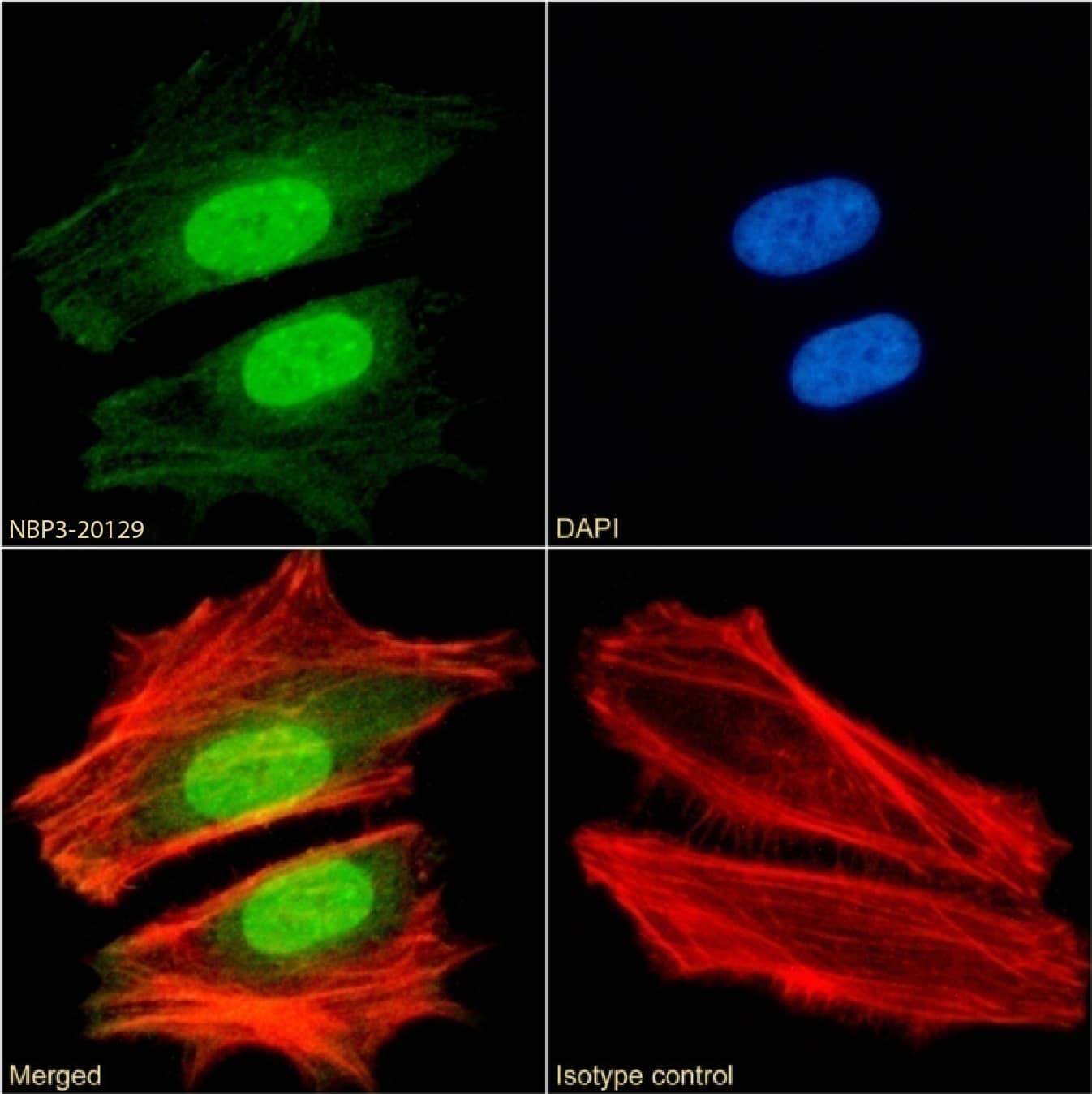 CBX1 Antibody (RAB-C145) - Chimeric - Azide and BSA Free