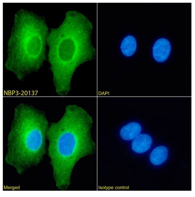 L3MBTL1 Antibody (RAB-C213) - Chimeric - Azide and BSA Free