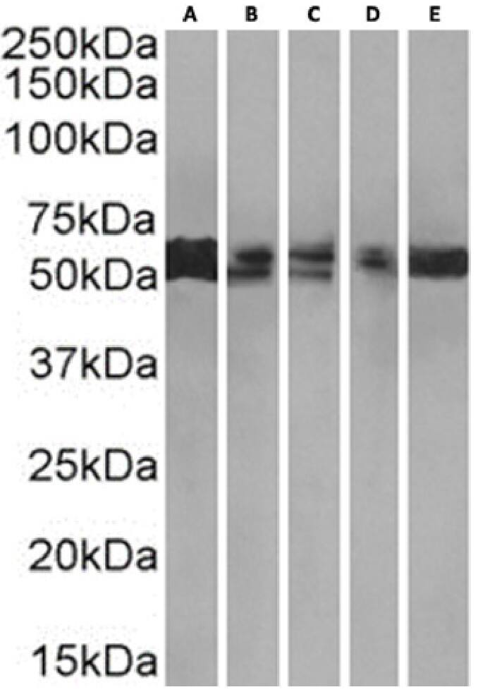 PRMT3 Antibody (RAB-C372) - Chimeric - Azide and BSA Free