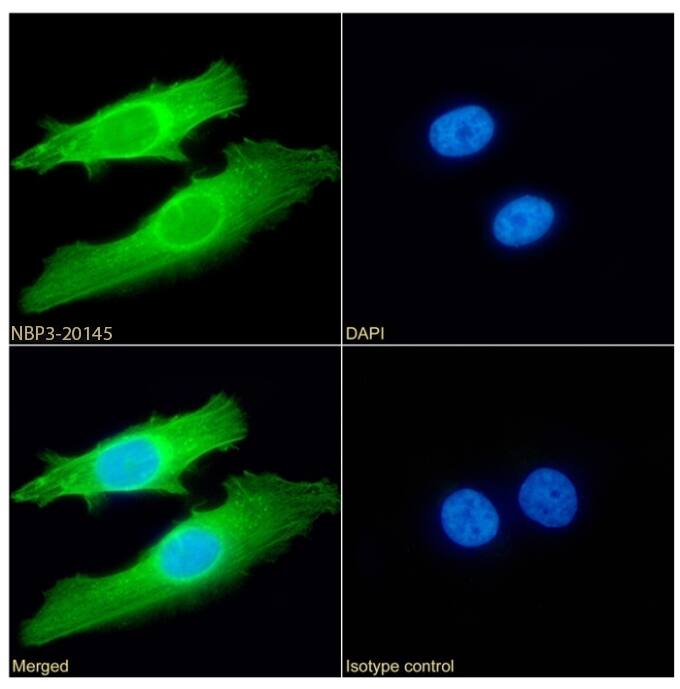 SETD7 Antibody (RAB-C220) - Chimeric - Azide and BSA Free