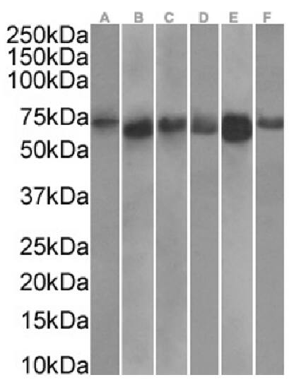 TDRD3 Antibody (RAB-C419) - Chimeric - Azide and BSA Free