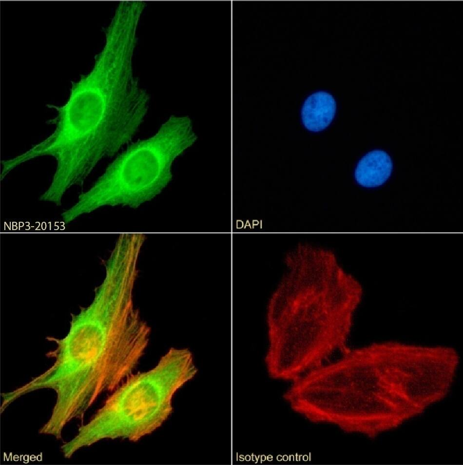 FoxP4 Antibody (RAB-S40) - Chimeric - Azide and BSA Free