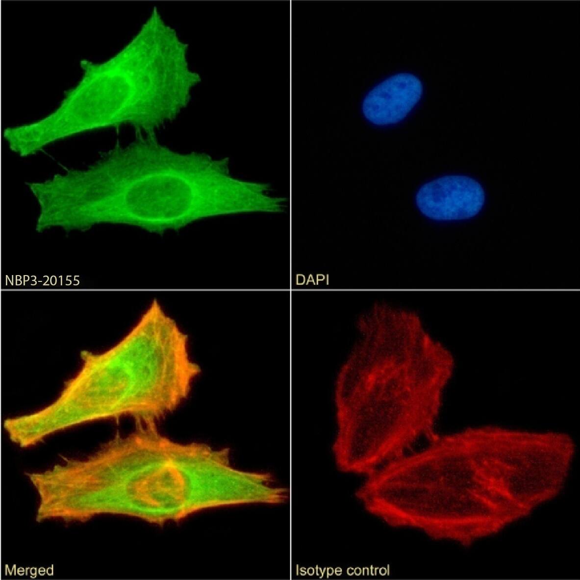 FoxP2 Antibody (RAB-S249) - Chimeric - Azide and BSA Free