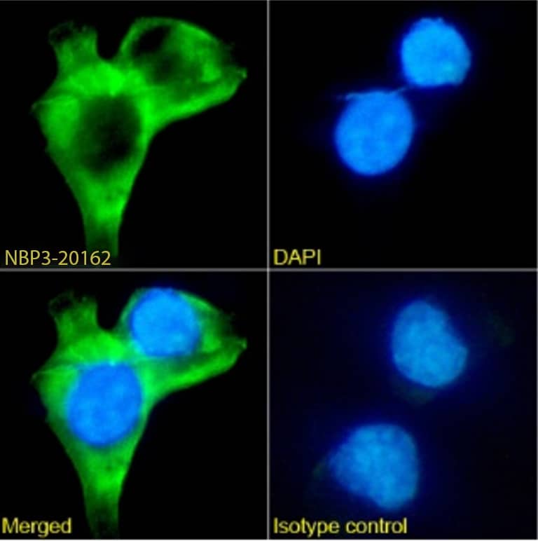 Tau Oligomeric Complex Antibody (TOC1) - Chimeric - Azide and BSA Free