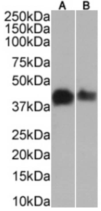 MAGEA3 Antibody (21B4) - Chimeric - Azide and BSA Free