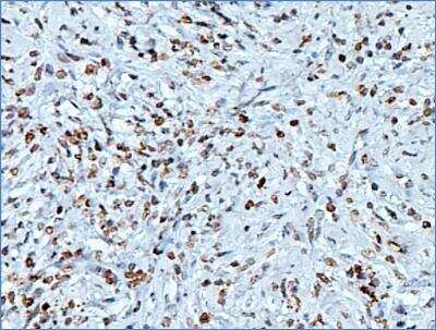 Acetyl Histone H3 Antibody Pack