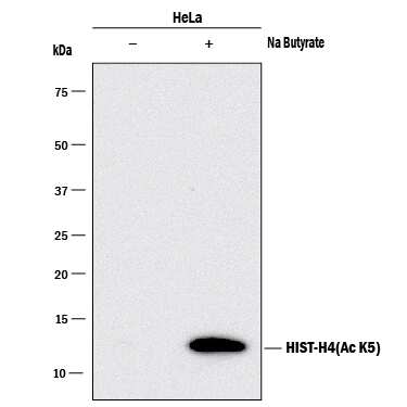Acetyl Histone H4 Antibody Pack