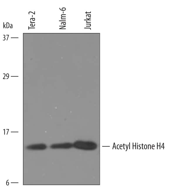 Acetyl Histone H4 Antibody Pack