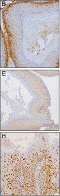 NFkB Pathway Antibody Pack