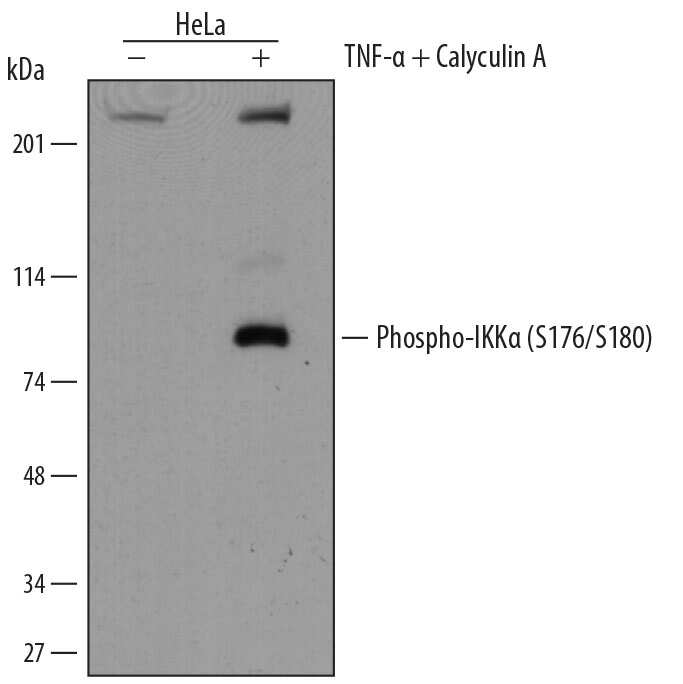 NFkB Pathway Antibody Pack