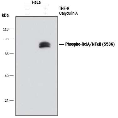 NFkB Pathway Antibody Pack
