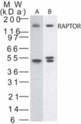 mTOR Complex 1 Antibody Pack