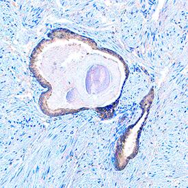 mTOR Complex 2 Antibody Pack