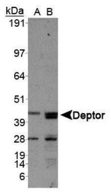 mTOR Complex 2 Antibody Pack