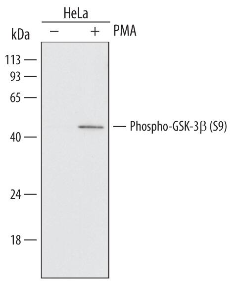 GSK3 Antibody Pack