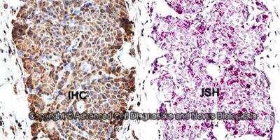Inhibitor of Apoptosis (IAP) Antibody Pack
