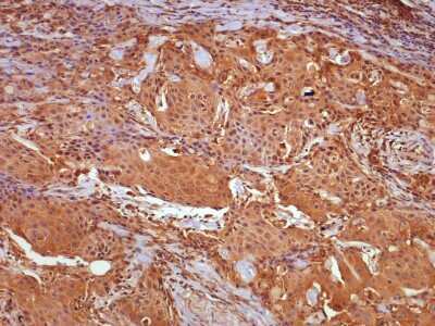 Inhibitor of Apoptosis (IAP) Antibody Pack