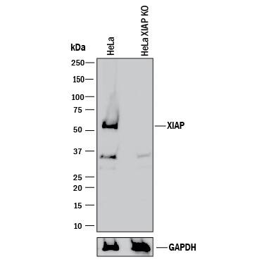 Inhibitor of Apoptosis (IAP) Antibody Pack