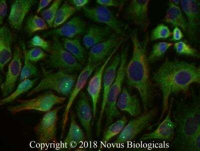 Mitochondrial Markers Antibody Pack