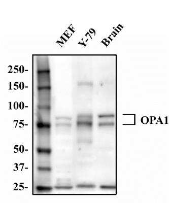 Mitochondrial Markers Antibody Pack