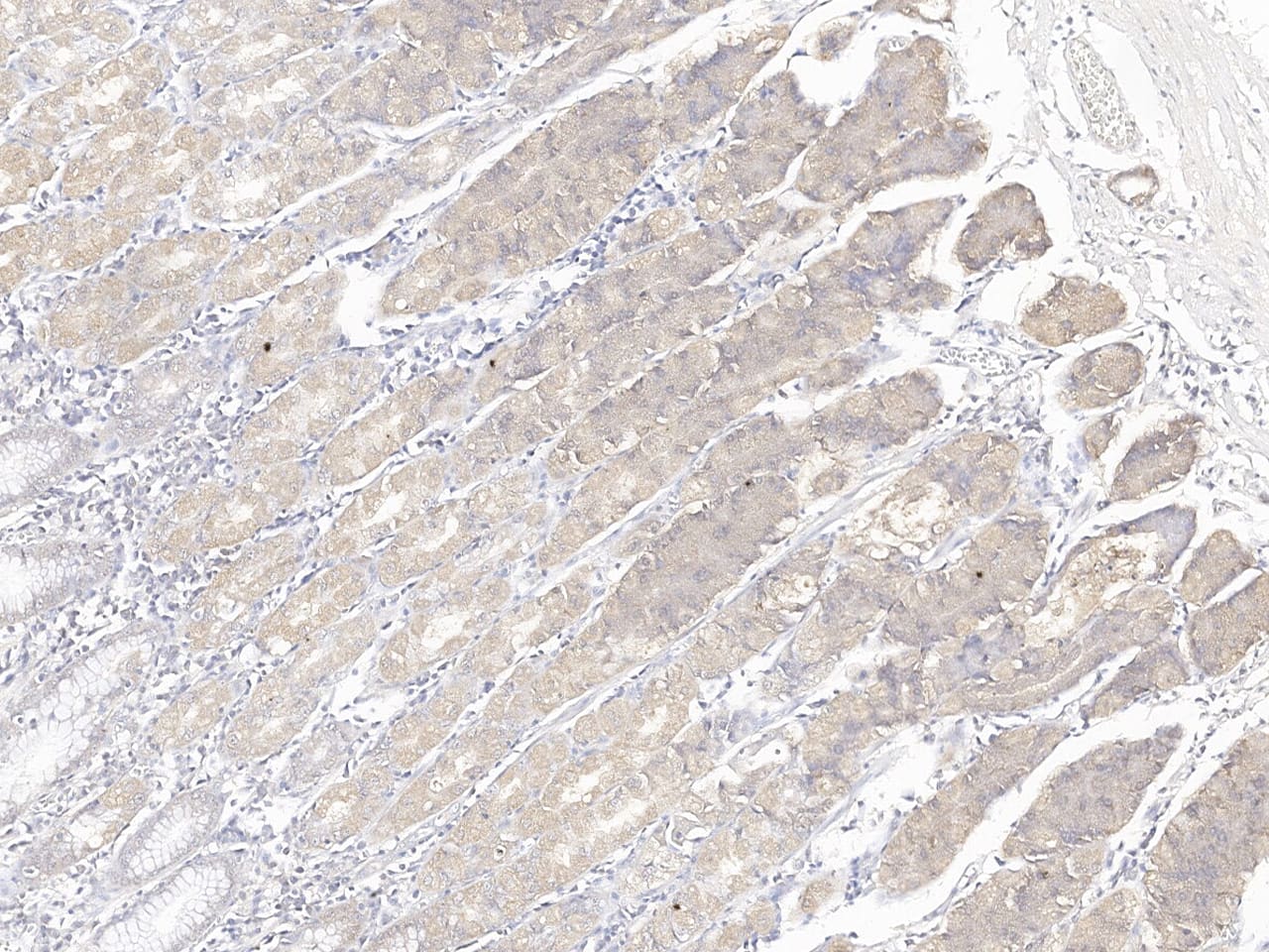 EFHC1 Antibody