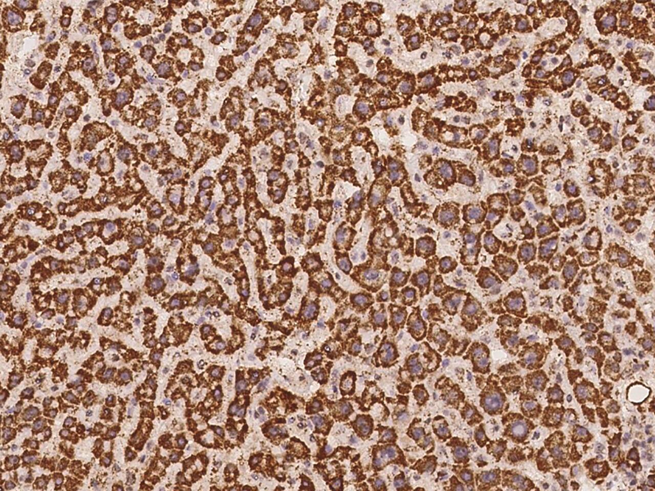 GNPNAT1 Antibody - BSA Free