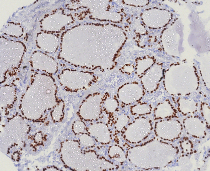 TTF-1 / NKX2-1 Antibody (TTF1/8123R)