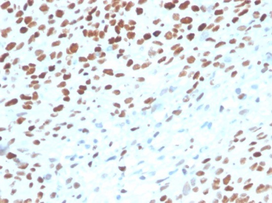 p53 Antibody (rTP53/3889)