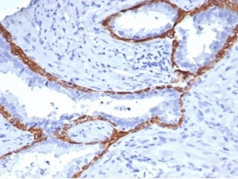 Cytokeratin 14 Antibody (KRT14/4131)