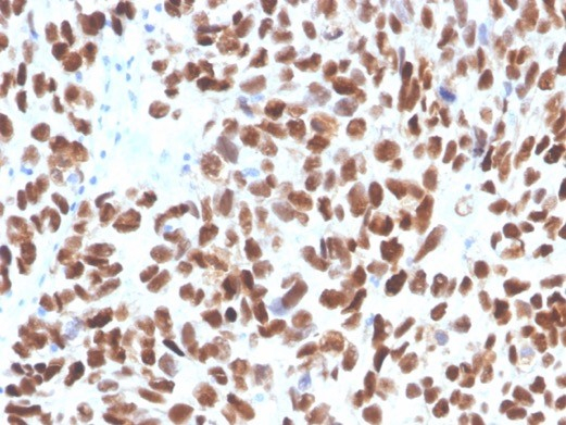 p53 Antibody (TP53/3890R)