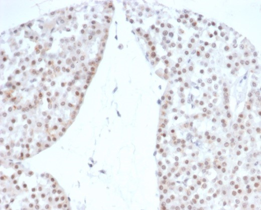 SF-1/NR5A1/Steroidogenic Factor 1 Antibody (rNR5A1/4369)