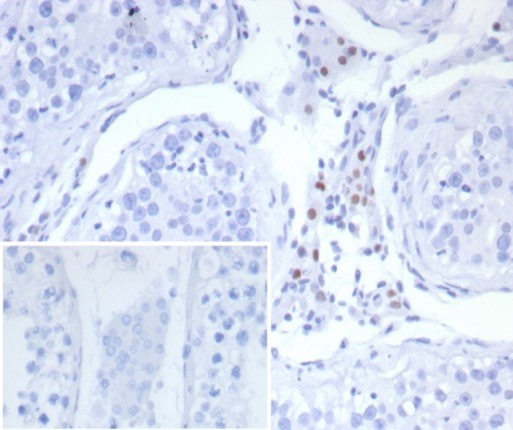 SF-1/NR5A1/Steroidogenic Factor 1 Antibody (SF1/8150R)