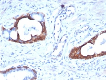 Cytokeratin 14 Antibody (KRT14/4127)