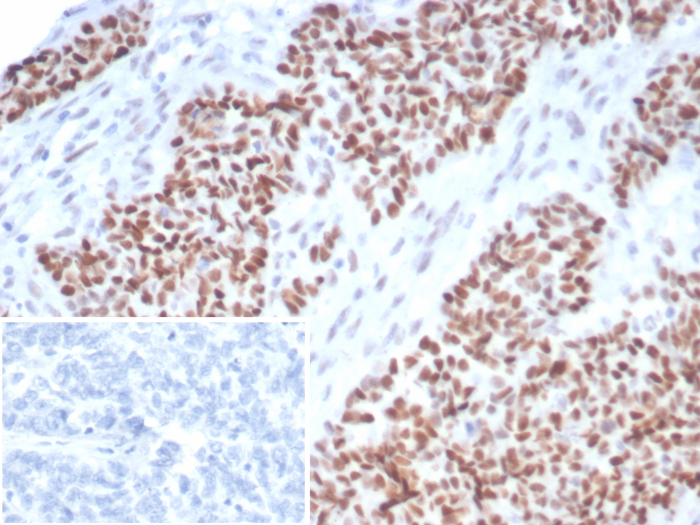 p53 Antibody (TP53/7082R)