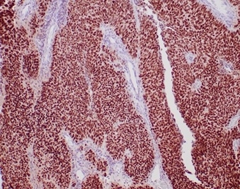 GATA-3 Antibody (rGATA3/3870)