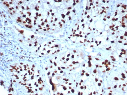 GATA-3 Antibody (GATA3/7685R)