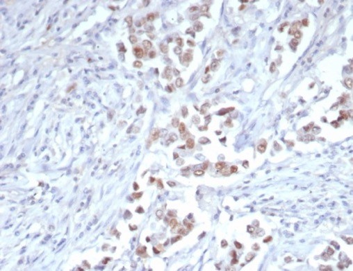 TRPS1 Antibody (TRPS1/7912R)