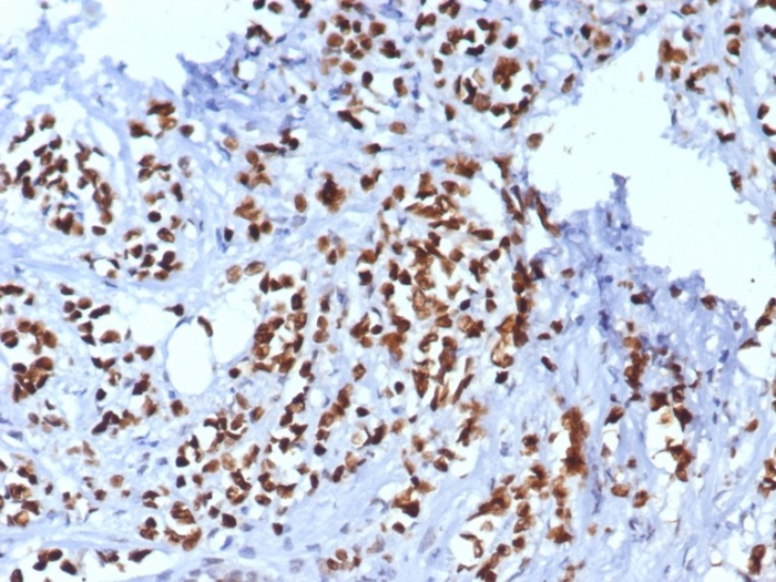 TRPS1 Antibody (TRPS1/8008R)