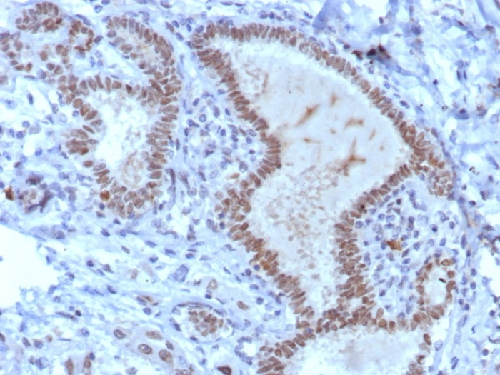 TRPS1 Antibody (TRPS1/8008R)