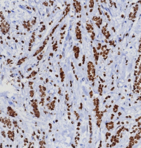 TRPS1 Antibody (TRPS1/8008R)