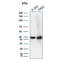 LEF1 Antibody (LEF1/6764) Western Blot: LEF1 Antibody (LEF1/6764) [NBP3-20278] -