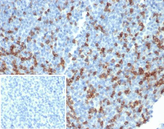 PD-1 Antibody (PDCD1/4231R) PD-1 Antibody (PDCD1/4231R) - Azide and BSA Free