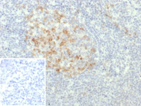 PD-1 Antibody (PDCD1/7276R)