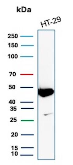Cytokeratin 20 Antibody (KRT20/7805R) Western Blot: Cytokeratin 20 Antibody (KRT20/7805R) [NBP3-20298] -