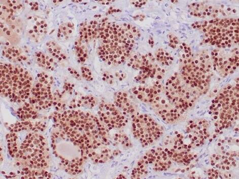 Pit1 Antibody (PIT1/7262) Pit1 Antibody (PIT1/7262) - Azide and BSA Free