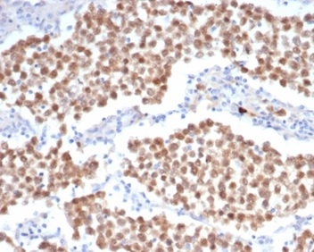 OCT4 Antibody (OCT4/6847R)