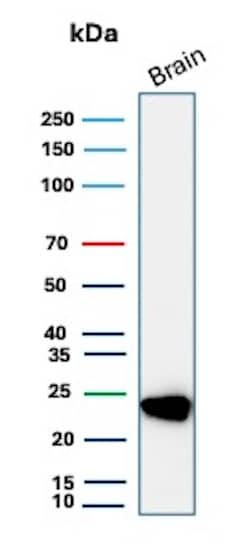 UCH-L1/PGP9.5 Antibody (UCHL1/8107R) Western Blot: UCH-L1/PGP9.5 Antibody (UCHL1/8107R) [NBP3-20303] -